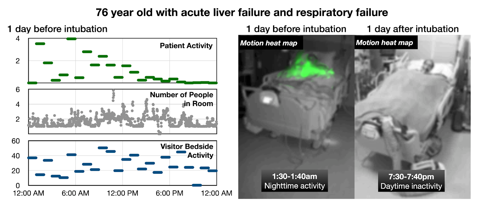 Hypoactive delirium: overnight reports and motion heat maps